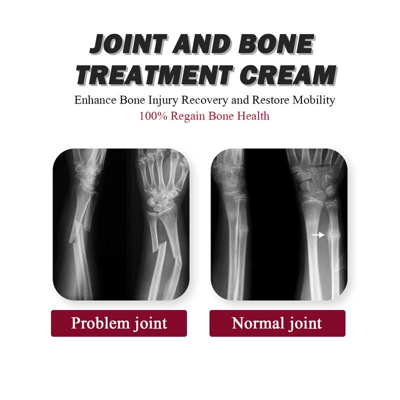 South Moon Joint & Bone Therapy Cream with Collagen, Intensive Concentrate for All Skin Types, Dual Pack (2 x 30g), Body Joint and Bone Care Formula