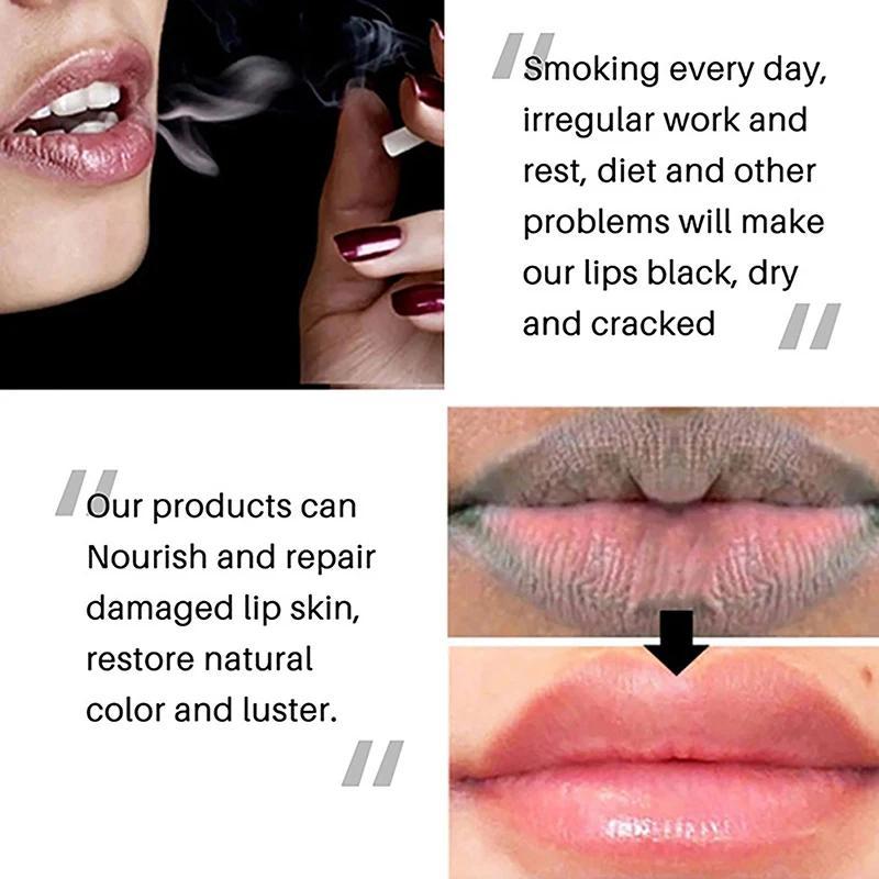 1PC Lips Pink Fresh Treatment Remove Dark Smoke Lips Lip Balm  Moisturizer Nourishing Essence