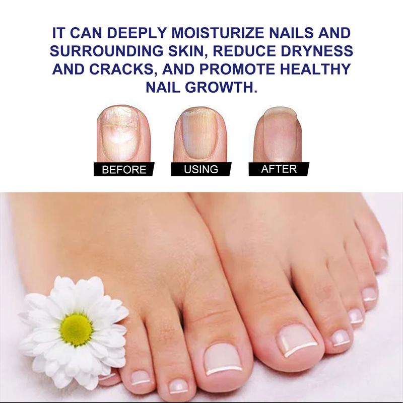 South Moon Nail Care Liquid Repairing Hands and Feet Soft Nails Thickening Brightening Nails Moisturizing Cleansing Nail Care Liquid (Onychomycosis)