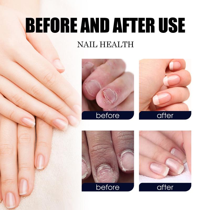 South Moon Nail Care Liquid Repairing Hands and Feet Soft Nails Thickening Brightening Nails Moisturizing Cleansing Nail Care Liquid (Onychomycosis)