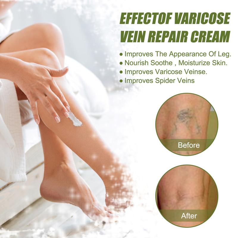 Black Friday EarlySales! Vitamin K Cream& Varicose Vein Repair & Soothing Cream #Vitamin K1+Hyaluronic Acid+Shea Butter #Enhance Moisturization #Massage Cream #Premium Formula for Bruises, Spider Veins, Dark Circles, Eyes, and Faces-60g