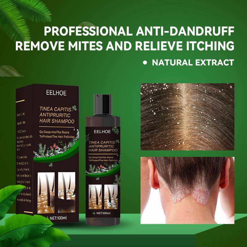 Scalp Repair Biological Shampoo,Anti Itch Dandruff Shampoo,Tinea Capitis Antipruritic Hair Shampoo,Dandruff Treatment Shampoo,Deep into the Roots,Protect the Hair Follicles black  Conditioner Haircare Aloe Comfort Cleanser Cleansing Conditioner Haircare