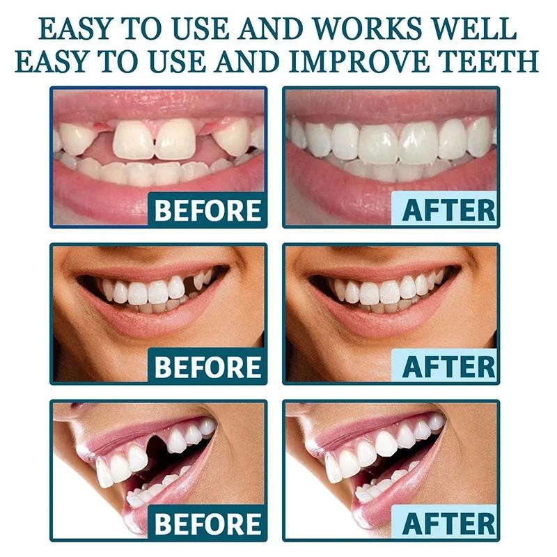 Adjustable Natural Denture Teeth Set Instant Smiling Veneer Denture Tooth Portable Braces Decorate Gaps Between Teeth