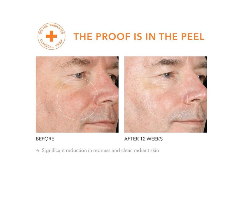 Alpha Beta® Extra Strength Daily Peel