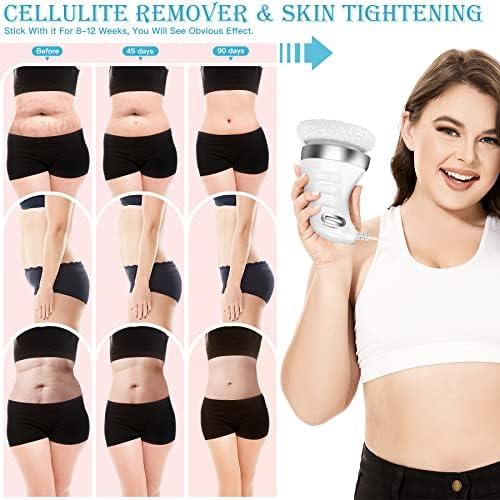 Cellulite Massager, Body Sculpting for Belly, Butt, Legs, Arms with 6 Washable Pads Comfort Body Care Skin Repair Skin Care Cosmetics