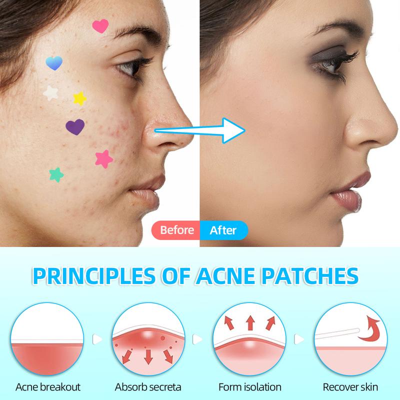 Pimple Patches for Face, Hydrocolloid Acne Patches, Cute Round Shape Zit Covers, Spot Stickers with Tea Tree, Salicylic Acid & Cica Oil 2 Sizes  Love Patch (216pcs) and Star Patch (240pcs) Count  Skincare Clear Skin Repair