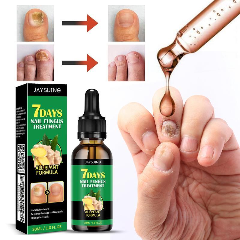 Ginger Nail Treatment Nail Support Nail Care, 7Days Nail Treatment Serum