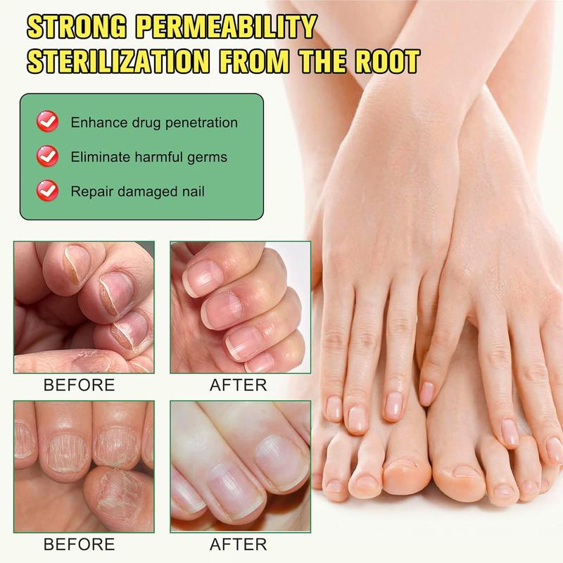 Ginger Nail Treatment Nail Support Nail Care, 7Days Nail Treatment Serum