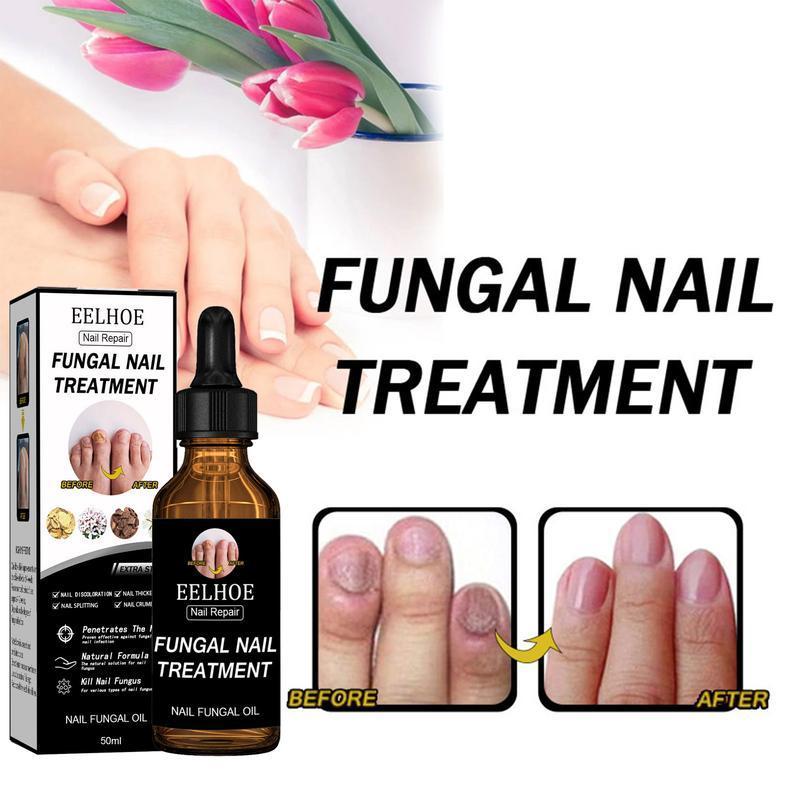 [Free Shipping]Nail Care Moisturizer+ Healmuse Fungal Prevention Solution.Nail Health Care Solution with Tea Tree Oil, Nail Care. Nail Art. Comfort. nail support