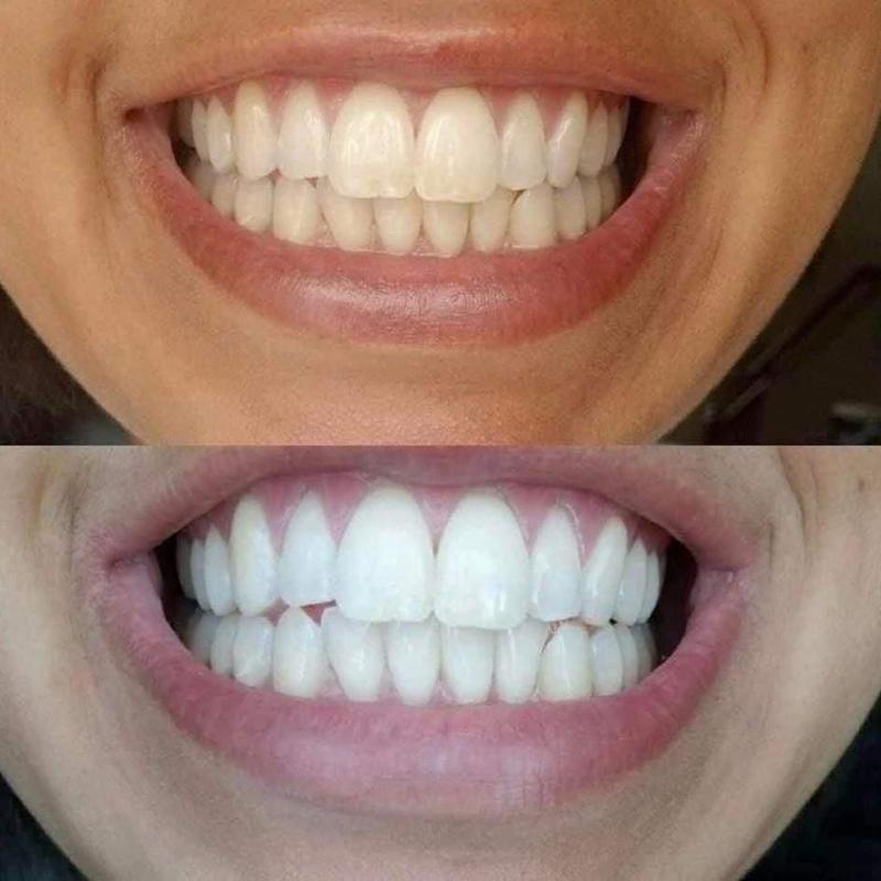 Ap24 Nuskin Whitening Toothpaste for Coffee Stain Removal Cleansing Oral - Long-Term Oral Hygiene