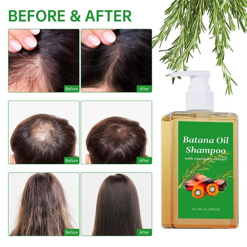 Batana Oil Shampoo, natural treatment toreduce hair loss and promote hair growth(10.14 0z 300 g),A favorite Christmas gift for boys and girls